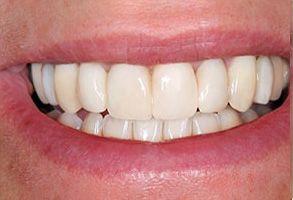 Axon Dental | Periodontal Treatment, Veneers and Pediatric Dentistry