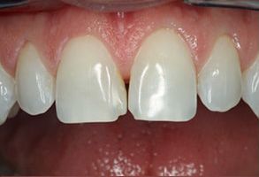 Axon Dental | CBCT, Root Canals and Cosmetic Dentistry